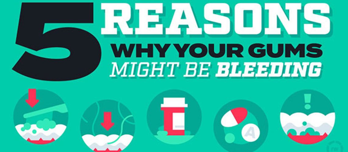5 Reasons why our gums might be bleeding